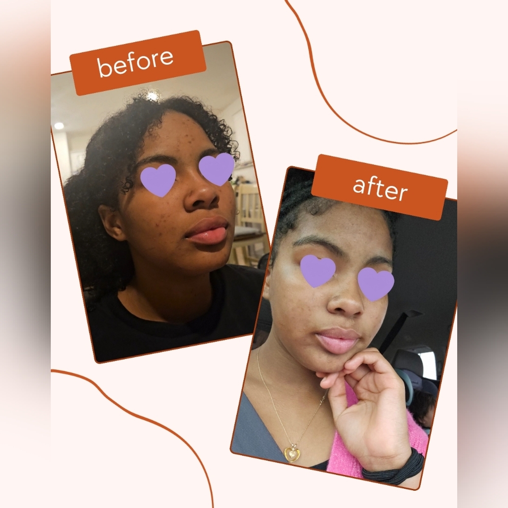 Essentials Skincare Duo - Black and Pink
